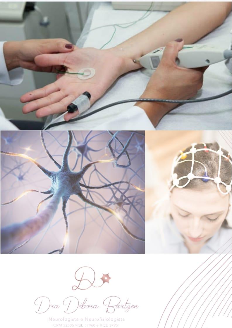 O que faz um médico neurofisiologista?